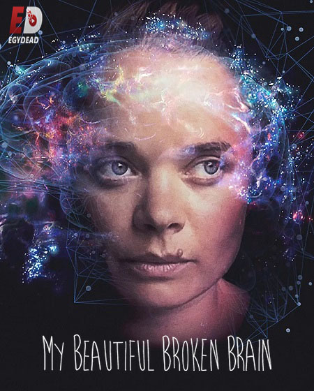 مشاهدة فيلم My Beautiful Broken Brain 2016 اون لاين